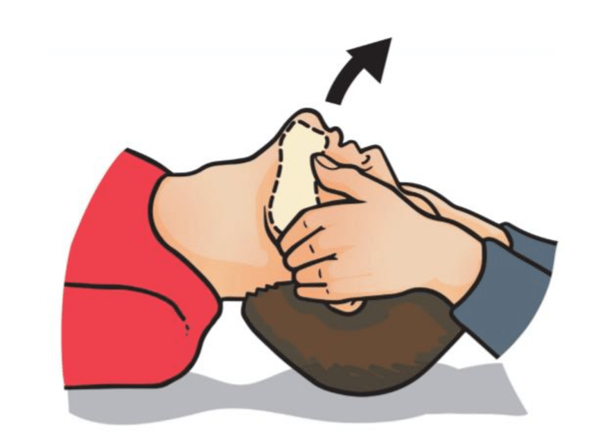 jaw thrust