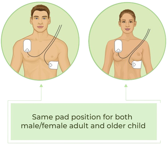 Attach AED pads to the victim’s bare chest