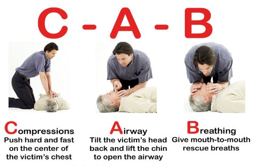 The Three Key Components of CPR (C-A-B)