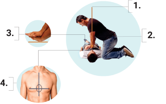 Performing Chest Compressions